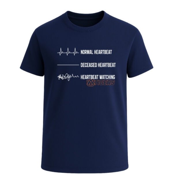 Heartbeat watching Auburn Tigers